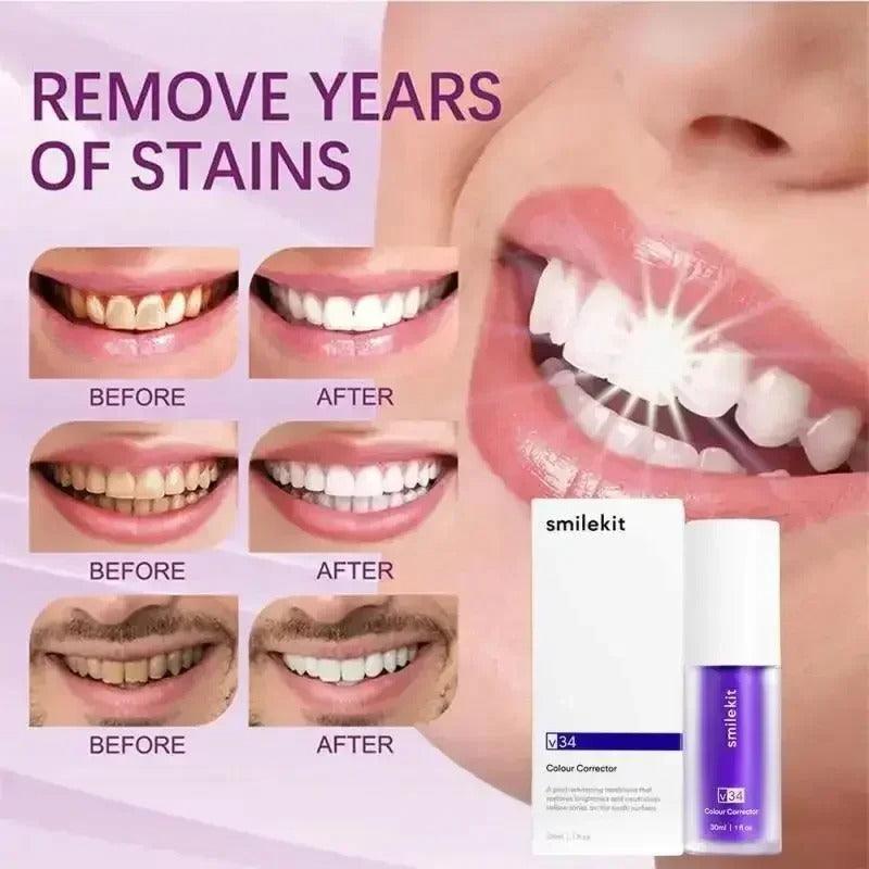 Crema Hismile v34 Morada Blanqueadora