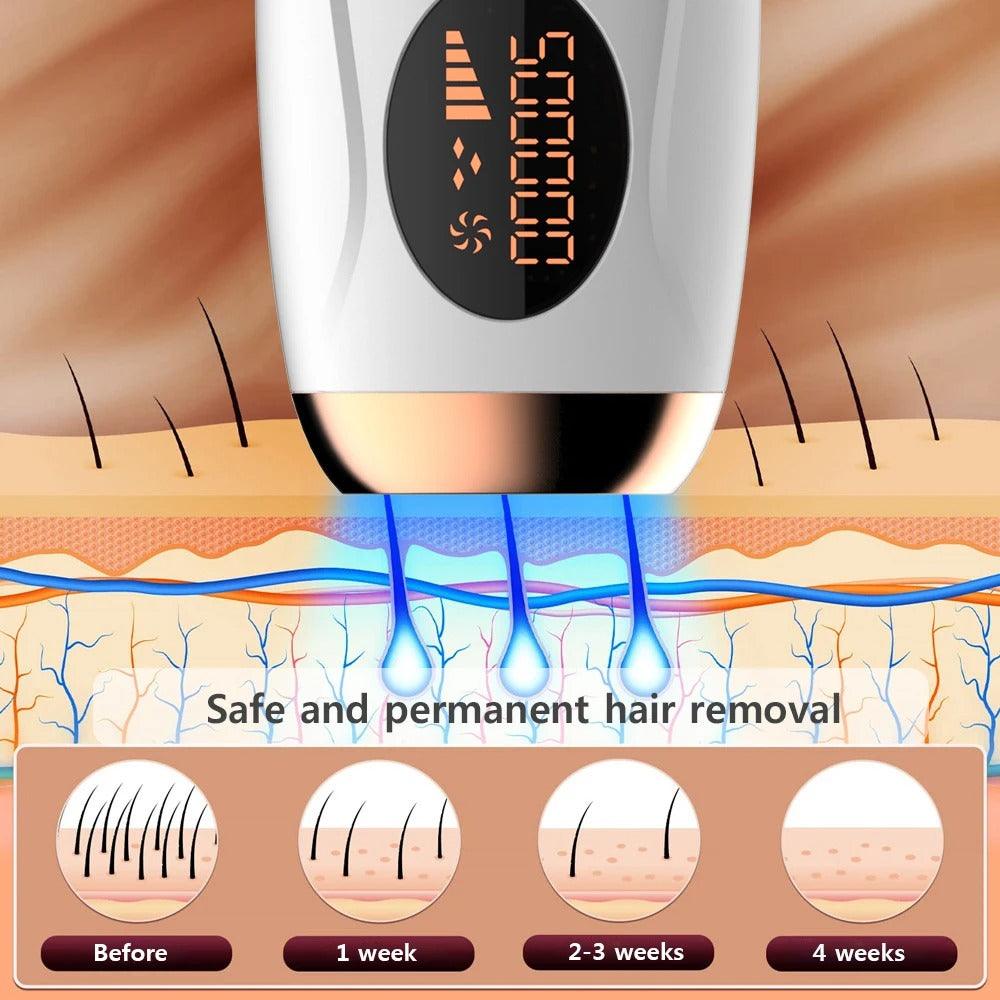 Máquina de depilación IPL profesional